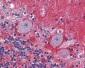AMPH / Amphiphysin Antibody (clone 3)